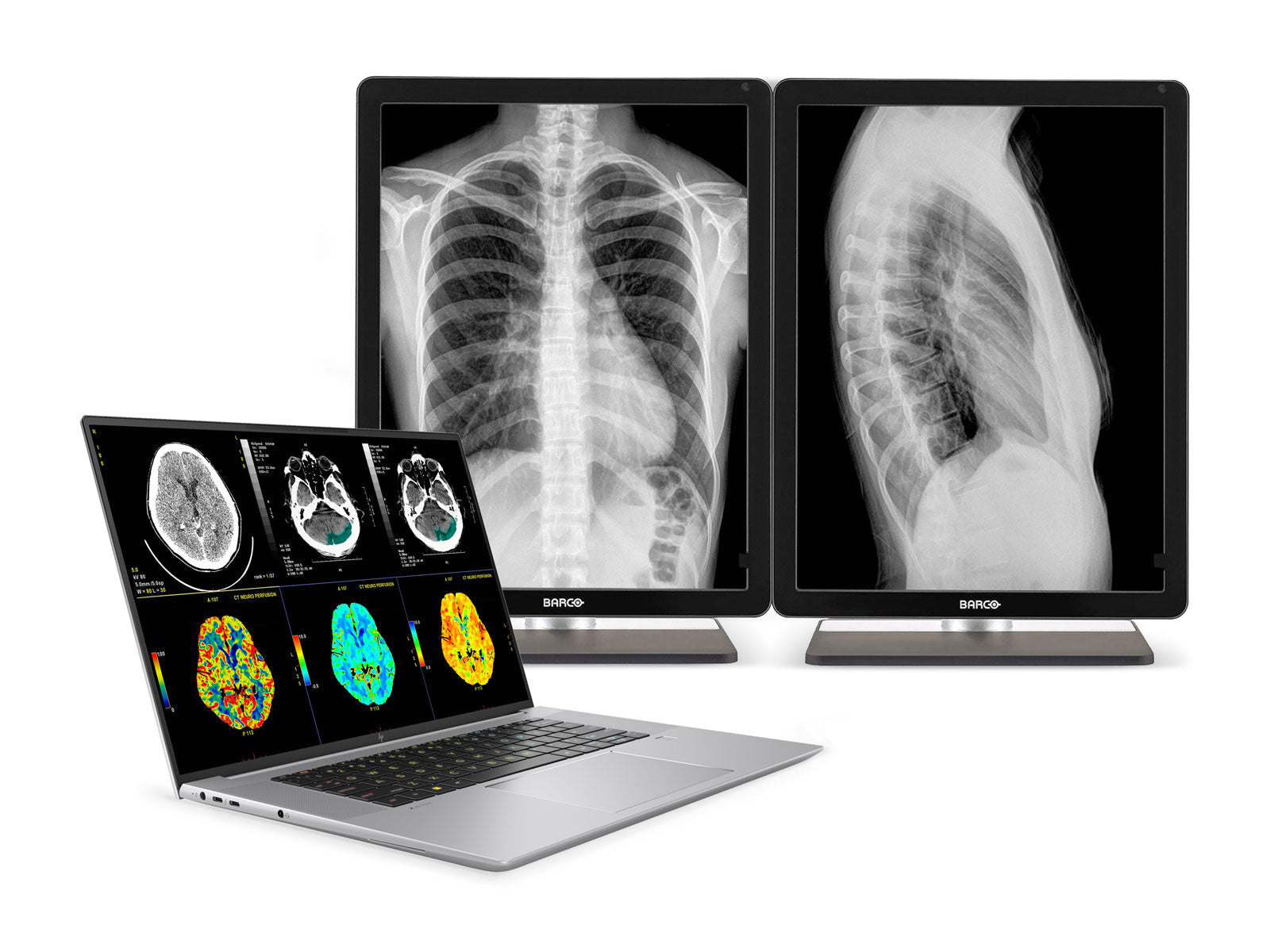 HP ZBook Studio 16 G10 Mobile Radiology Workstation | 16" WQUXGA 8MP+ DICOM Calibrated | Core i7-13800H @ 5.2GHz | 64GB DDR5 | 512GB NVMe SSD | NVIDIA RTX A1000 6GB | Win11 Pro Monitors.com 