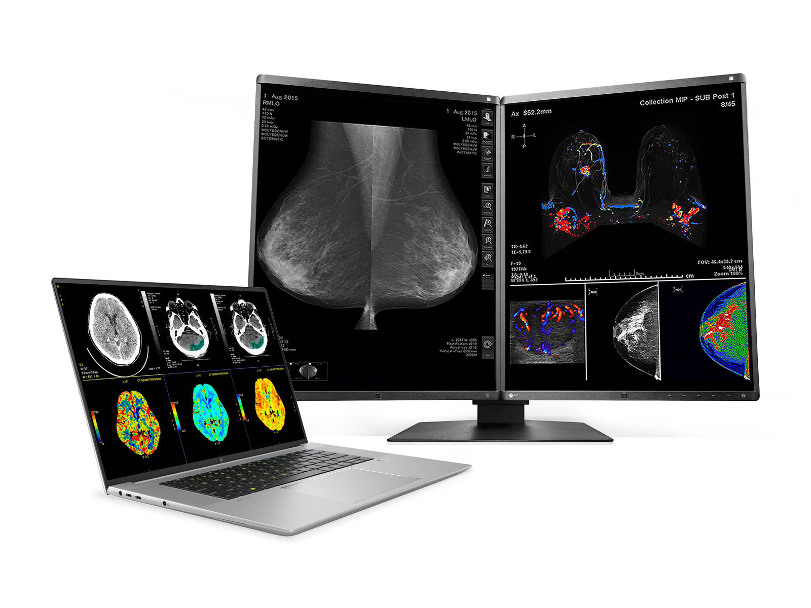 HP ZBook Studio 16 G10 Mobile Radiology Workstation | 16" WQUXGA 8MP+ DICOM Calibrated | Core i7-13800H @ 5.2GHz | 64GB DDR5 | 512GB NVMe SSD | NVIDIA RTX A1000 6GB | Win11 Pro Monitors.com 