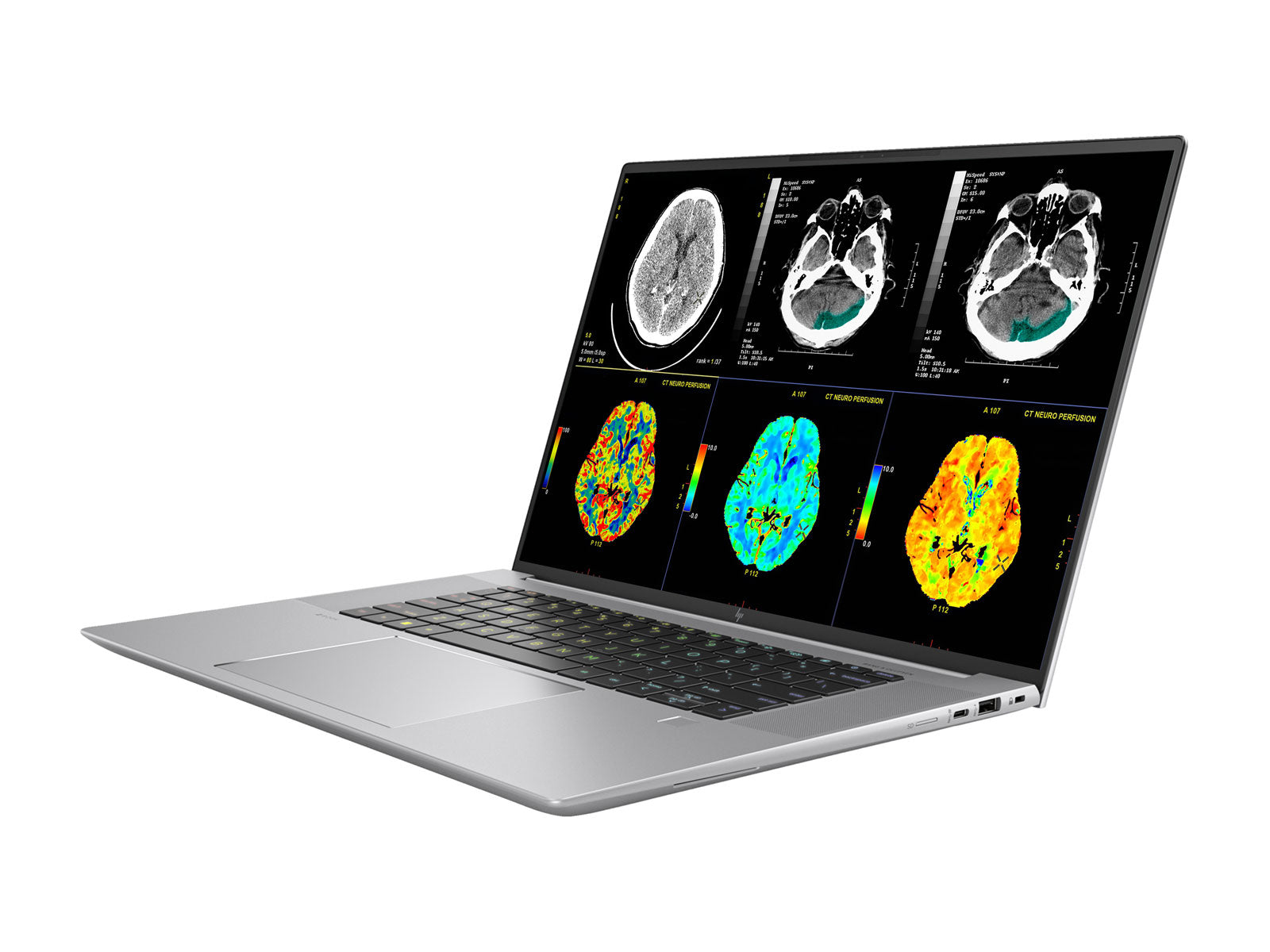 محطة عمل الأشعة المتنقلة HP ZBook Studio 16 G10 | معايرة 16 بوصة بدقة 9 ميجابكسل بدقة 4K + UHD DICOM | معالج Core i9-13900H @ 5.40 جيجا هرتز | 14 نواة | ذاكرة DDR5 سعة 64 جيجابايت | 1 تيرابايت NVMe SSD | RTX 2000 Ada 8 جيجابايت | واي فاي 6E | Win10-11 برو