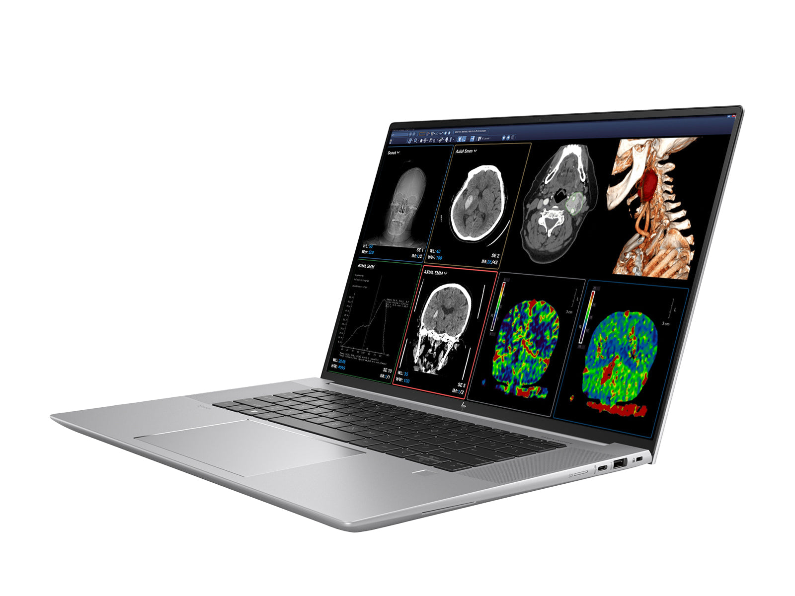 HP ZBook Studio 16 G9 Mobile Radiology Workstation | 16" WQUXGA 8MP+ DICOM Calibrated | Core i9-12900H @ 5.00GHz | 64GB DDR5 | 1TB NVMe SSD | Nvidia RTX A4500 16GB| Win11 Pro Monitors.com 