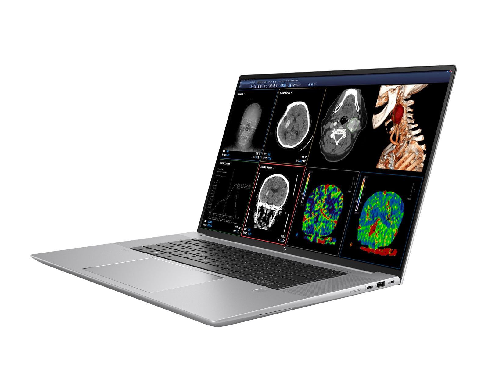 Station de travail mobile de radiologie HP ZBook Studio 16 G9 | 16" OLED 8MP 4K UHD DICOM Calibré | Core i9-12900H @ 5,0 GHz | 32 Go de mémoire DDR5 | Disque SSD NVMe de 512 Go | RTX A2000 8 Go | Win11 Pro