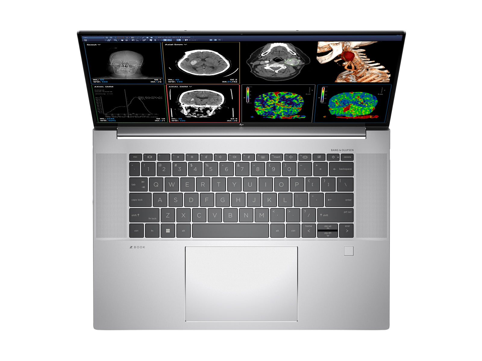 HP ZBook Studio 16 G9 Mobile Radiology Workstation | 16" 8MP 4K UHD DICOM Calibrated | Core i7-12700H @ 4.80GHz | 64GB DDR5 | 1TB NVMe SSD | Nvidia RTX A1000 4GB