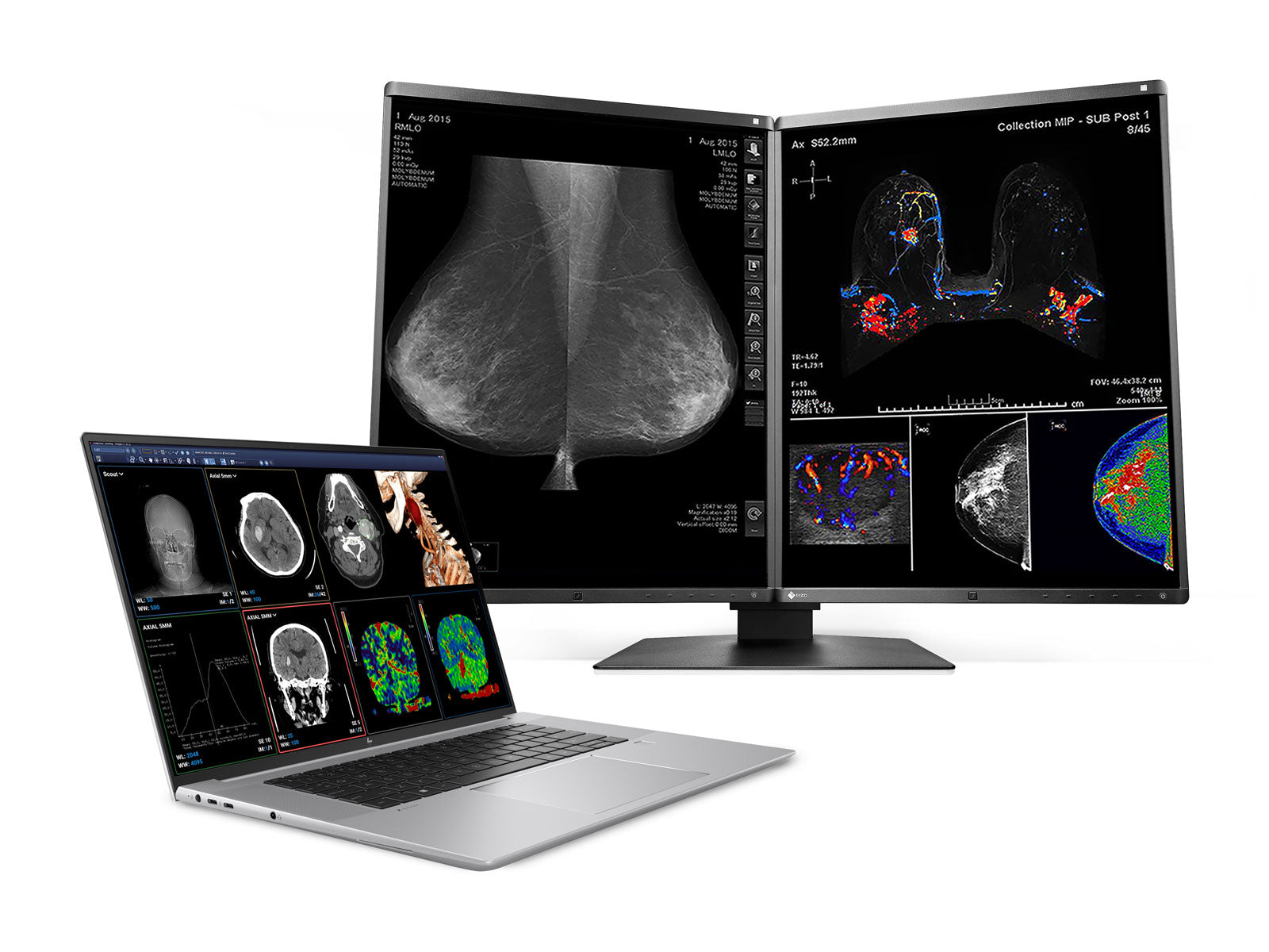 Station de travail mobile de radiologie HP ZBook Studio 16 G9 | 16" OLED 8MP 4K UHD DICOM Calibré | Core i9-12900H @ 5,0 GHz | 32 Go de mémoire DDR5 | Disque SSD NVMe de 512 Go | RTX A2000 8 Go | Win11 Pro