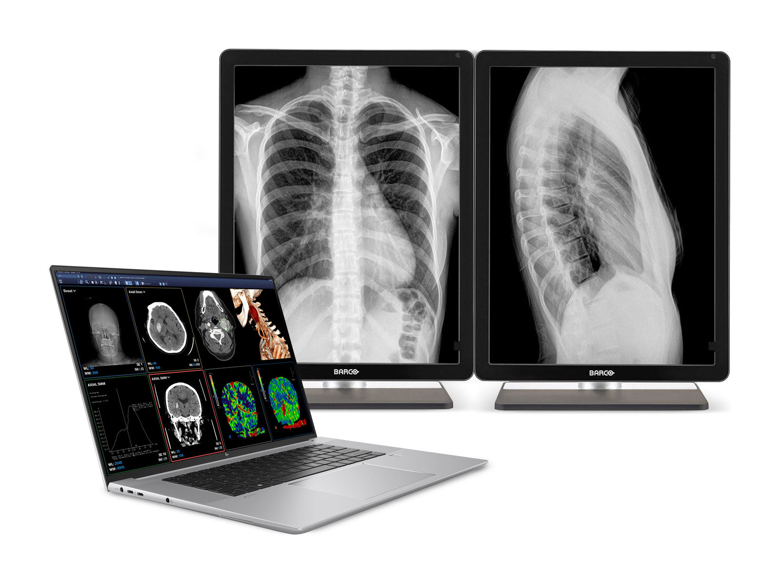 HP ZBook Studio 16 G9 Estación de trabajo móvil de radiología | 16 "OLED 9MP 4K UHD DICOM calibrado | Core i9-12900H @ 5.00GHz | 64GB DDR5 | 1TB SSD NVMe | Nvidia RTX A2000 8GB
