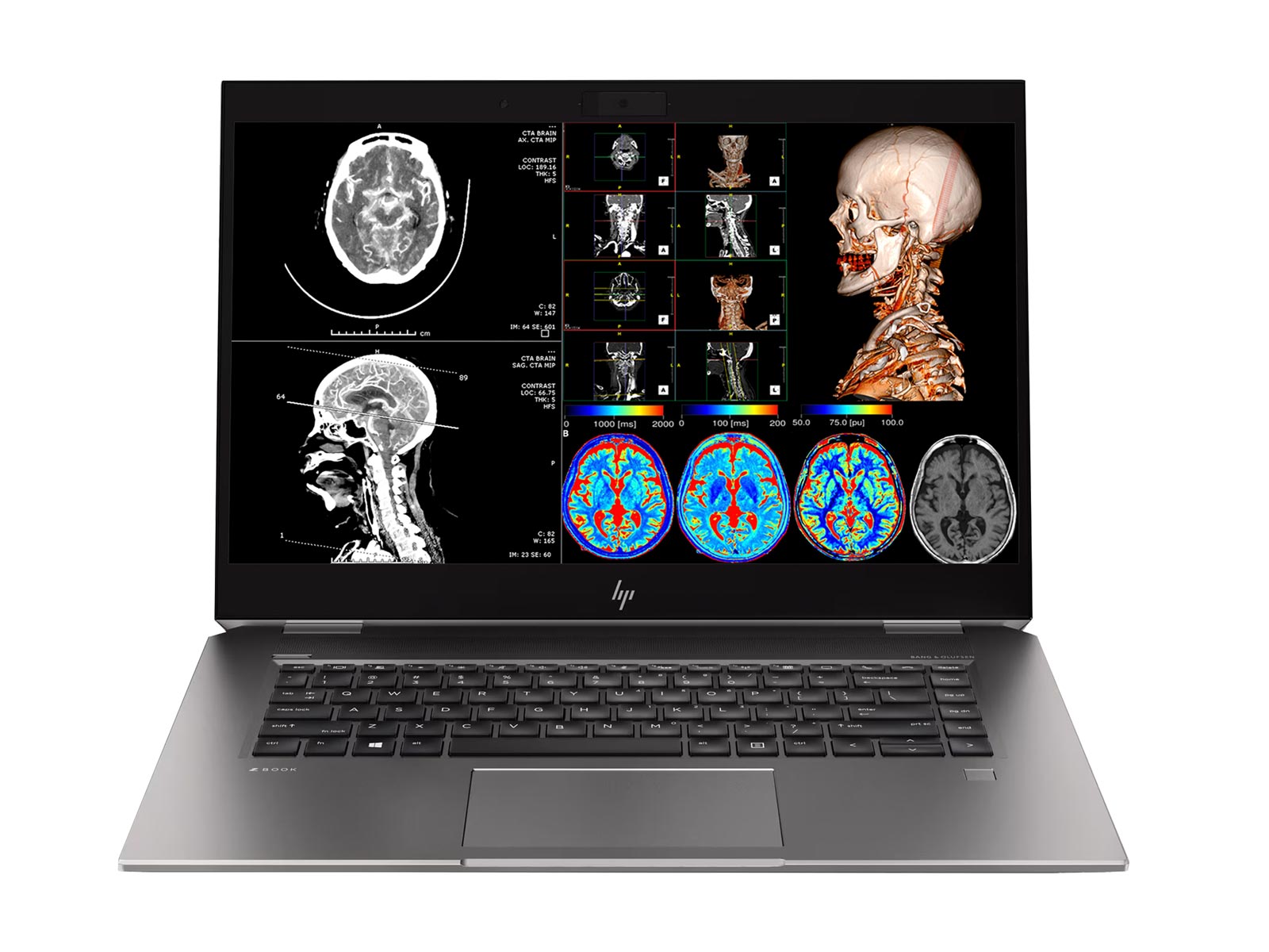 HP ZBook Studio G5 Mobile Radiology Workstation | 15.6" 4K LED | Intel Core i7-8850H @ 4.30GHz | Hexa Core (6-Core) | 32GB DDR4 2666MHz | 500GB NVMe | NVIDIA P2000 4GB | Win10 Pro