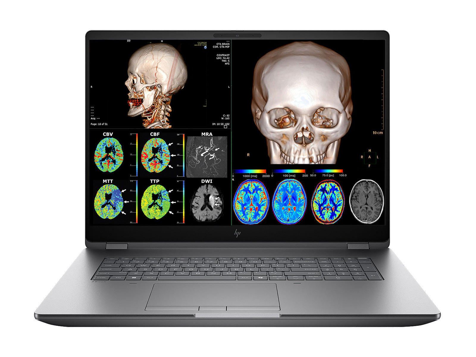 HP ¡ZBook Fury Estación de trabajo móvil G1i 18 | ¡18" DICOM calibrado WQXGA QHD+ 4MP (2560 x 1600) Pantalla | Intel Core Ultra 7 265HX @ 5.3GHz MT | ¡20-Core | 128GB DDR5 | SSD NVMe de 512GB | Intel Gráficos UHD | WiFi 7 | ¡Licencia PerfectLUM