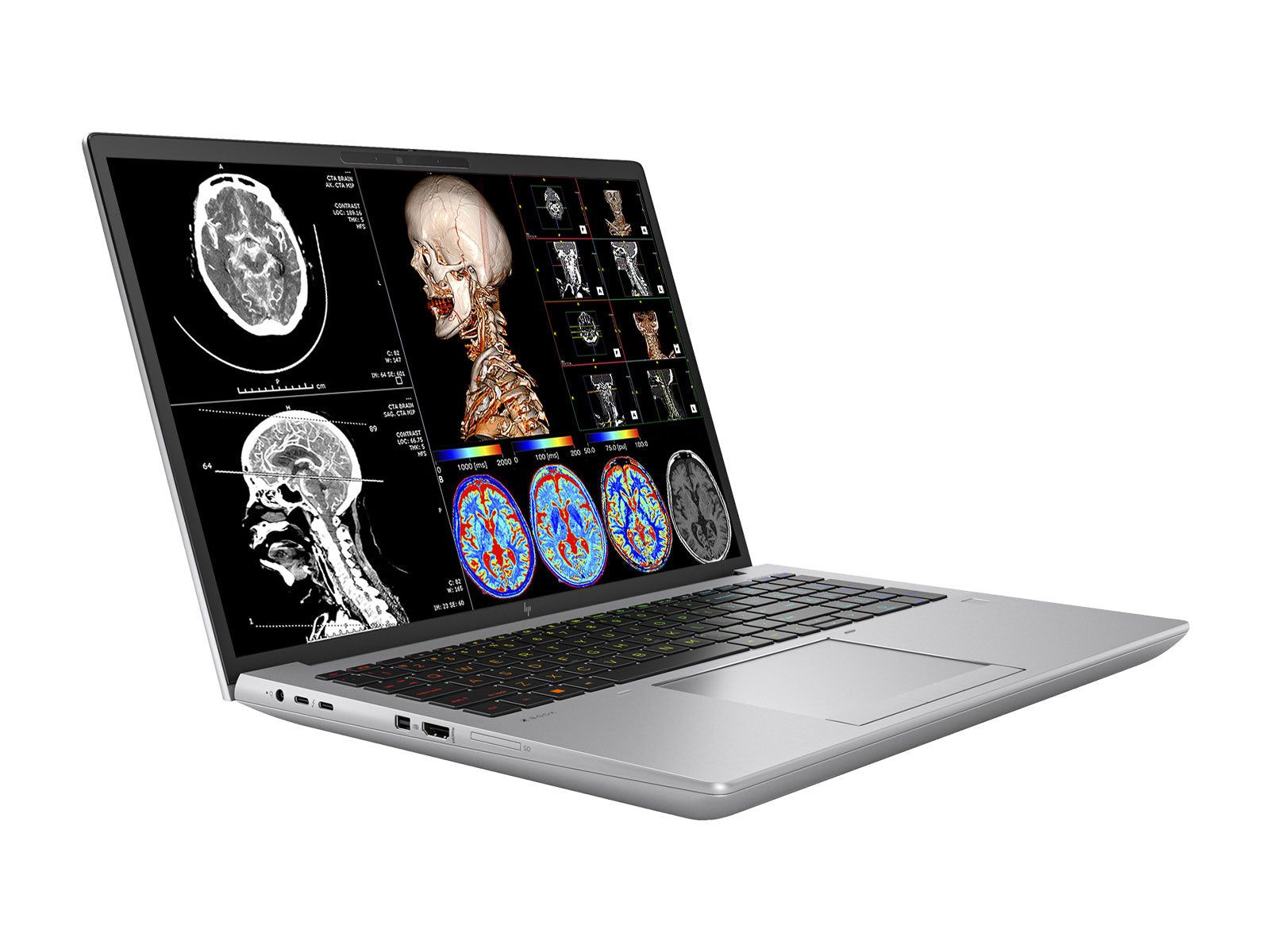 Φορητός σταθμός εργασίας ακτινολογίας HP ZBook Fury 16 G9 | Βαθμονόμηση 16" 9MP 4K UHD DICOM | Πυρήνων i7-12800HX @ 4.80GHz | 16-πύρηνος | 32 GB DDR5 | Μονάδα SSD NVMe 1 TB | Radeon Pro W6600M 8GB | WiFi 6 | Win10-11 Υπέρ