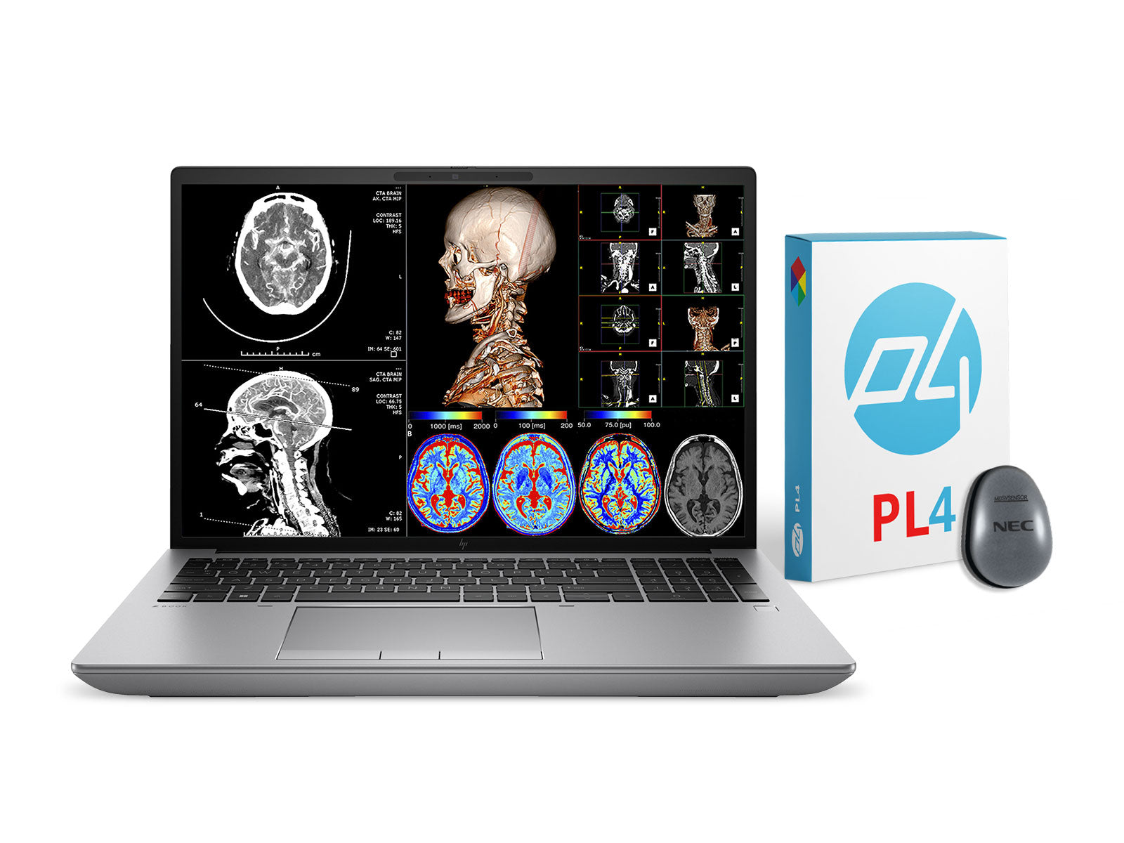 Φορητός σταθμός εργασίας ακτινολογίας HP ZBook Fury 16 G9 | Βαθμονόμηση 16" 9MP 4K UHD DICOM | Πυρήνων i7-12800HX @ 4.80GHz | 16-πύρηνος | 32 GB DDR5 | Μονάδα SSD NVMe 1 TB | Radeon Pro W6600M 8GB | WiFi 6 | Win10-11 Υπέρ