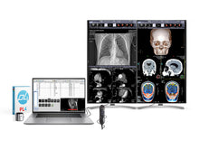 Complete Clinical Review Reading Station | 2 x LG 27M-W 27" 8MP Color Clinical Review Displays | HP ZBook Studio 16 G9 | Dictation Mic | PerfectLUM Calibration Package (LGHP16G9)
