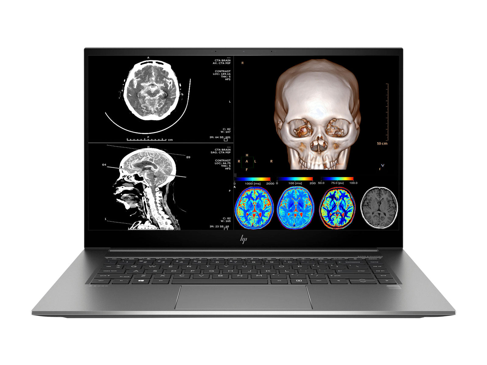 HP ZBook Studio 15 G8 Mobile Radiology Workstation | 15.6" 4K LED | Core i7-11800H @ 4.60GHz | 8-Core | 16GB DDR4 | 512GB NVMe SSD | Quadro RTX T1200 4GB