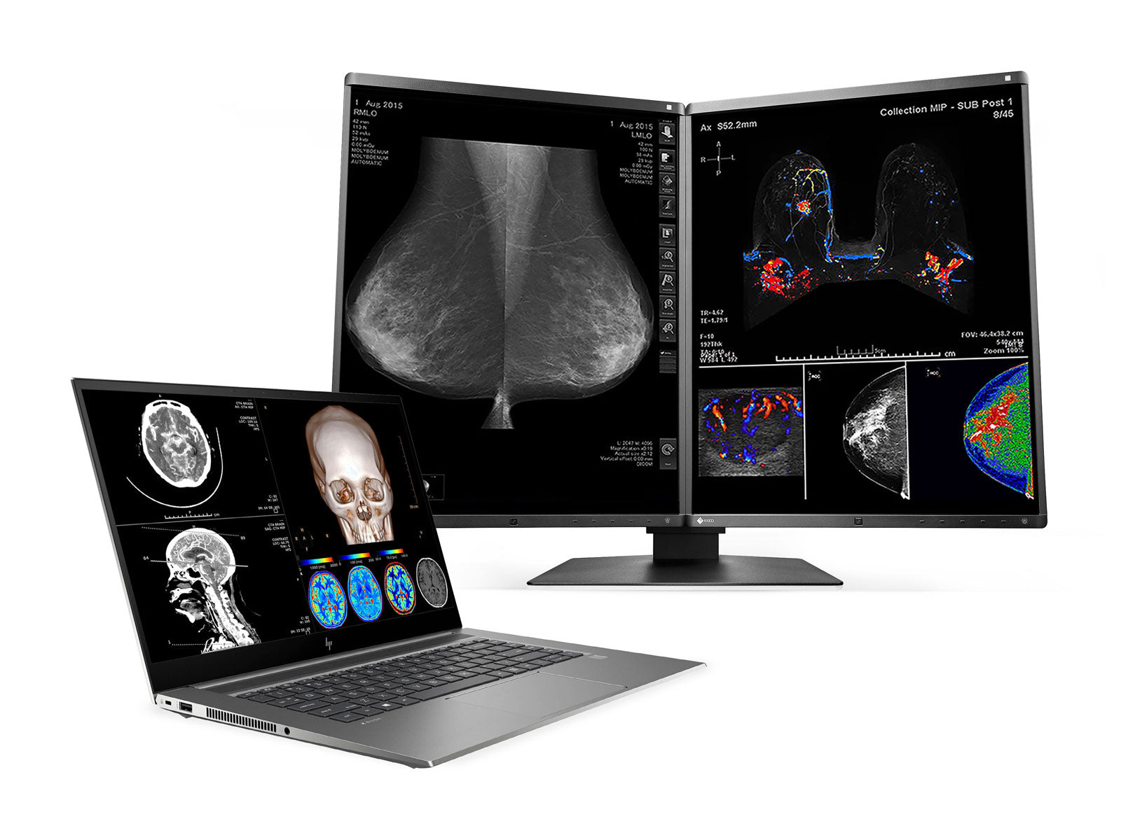 HP ZBook Studio 15 G8 Mobile Radiology Workstation | 15.6" 4K LED | Core i7-11800H @ 4.60GHz | 8-Core | 16GB DDR4 | 512GB NVMe SSD | Quadro RTX T1200 4GB