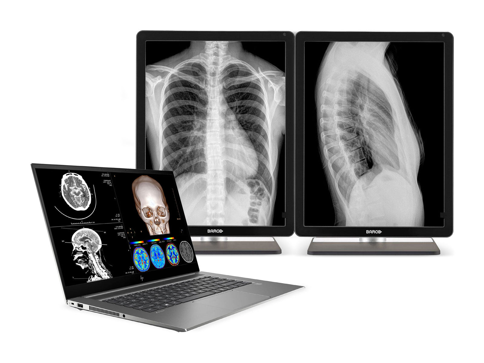 HP ZBook Studio 15 G8 Mobile Radiology Workstation | 15.6" 4K LED | Core i7-11800H @ 4.60GHz | 8-Core | 16GB DDR4 | 512GB NVMe SSD | Quadro RTX T1200 4GB