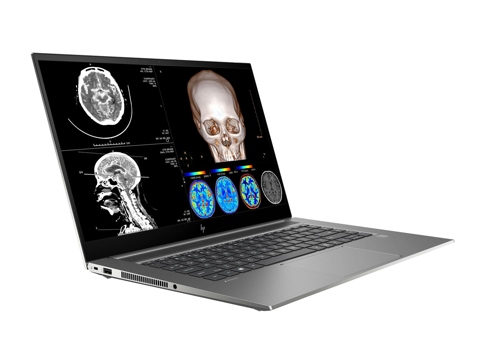 HP ZBook Studio 15 G8 Mobile Radiology Workstation | 15.6" 4K LED | Core i7-11800H @ 4.60GHz | 8-Core | 16GB DDR4 | 512GB NVMe SSD | Quadro RTX T1200 4GB