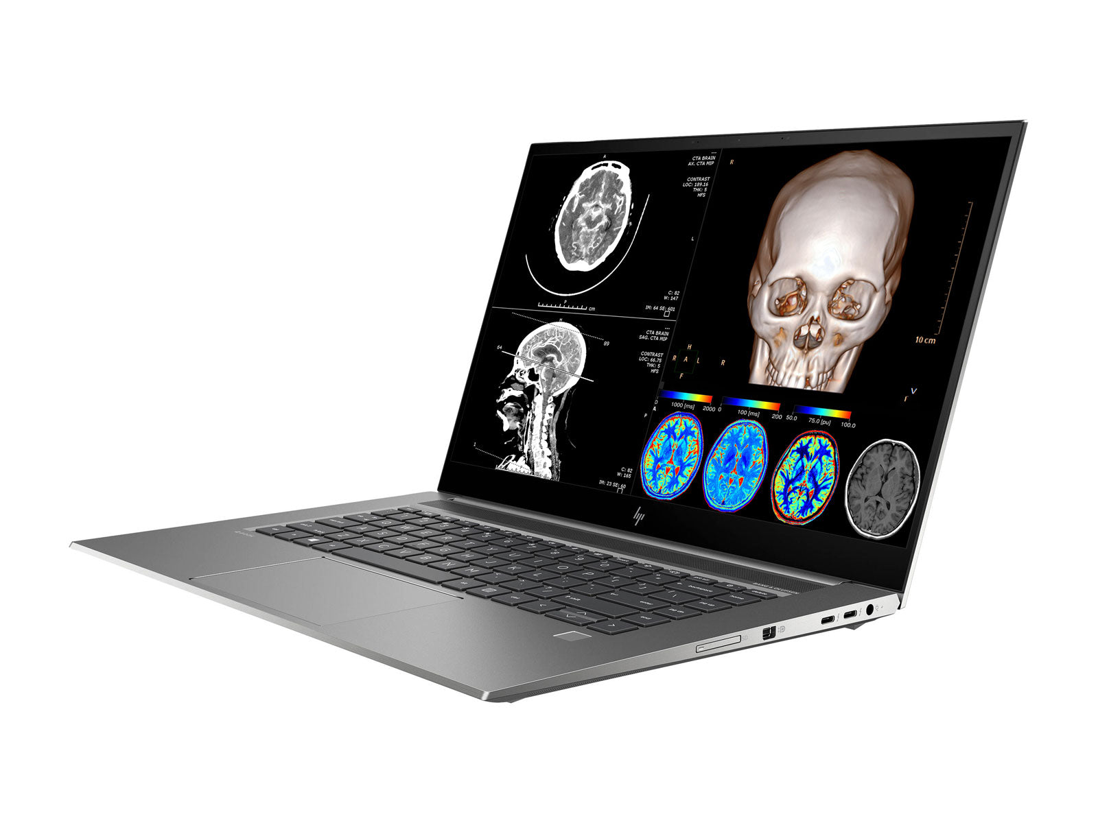 HP ZBook Studio 15 G8 Mobile Radiology Workstation | 15.6" 4K LED | Core i7-11800H @ 4.60GHz | 8-Core | 16GB DDR4 | 512GB NVMe SSD | Quadro RTX T1200 4GB