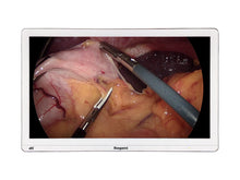 Ikegami MLW-2750UHD 27 POLLICI 4K Monitor di esposizione chirurgico (MLW-2750UHD)