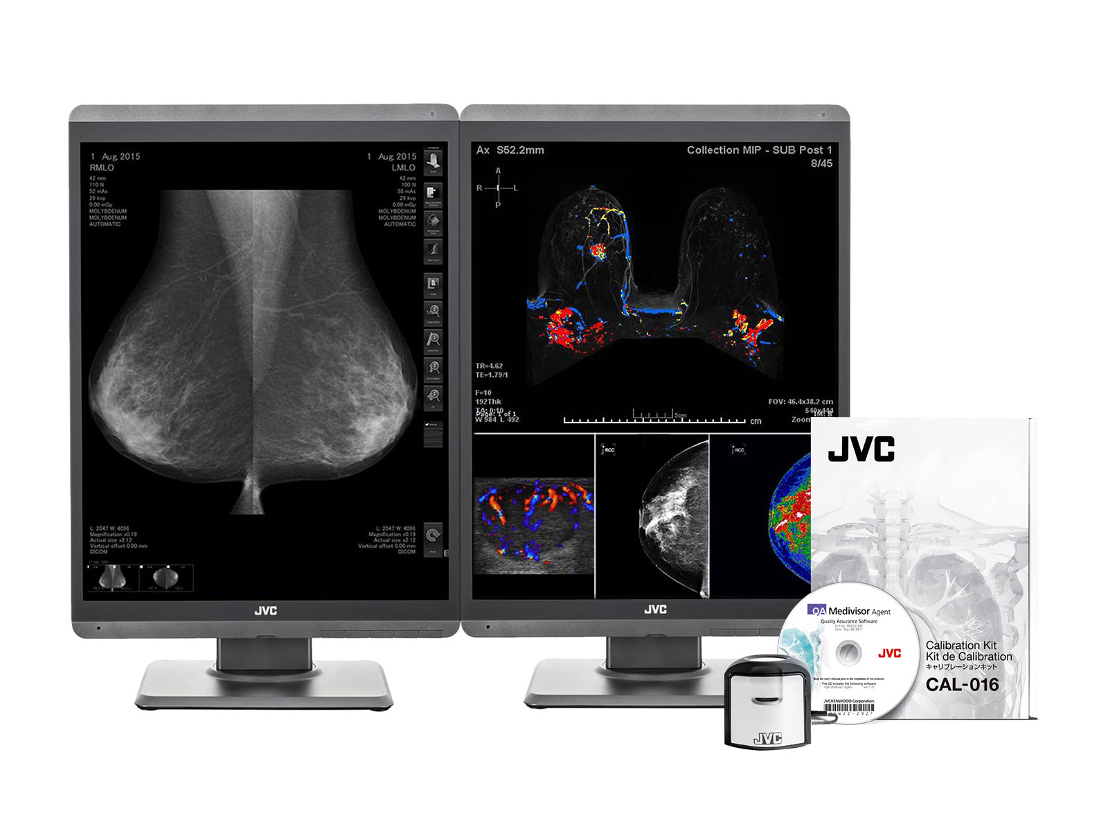 Paire (x2) JVC Totoku CL-S500 5MP Écran d'imagerie mammaire LED couleur Mammo 3D-DBT de 21 po (CL-S500)