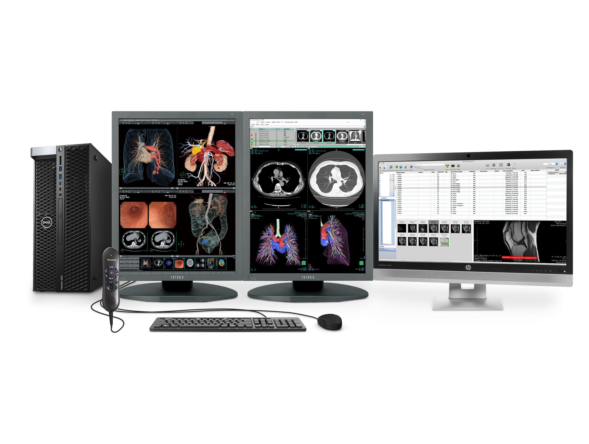 Station complète de radiologie générale PACS | Écrans LED couleur Eizo 4MP | Poste de travail Dell