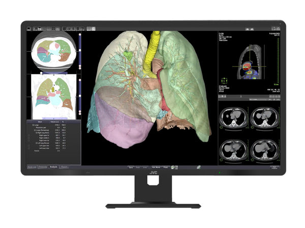 Complete PACS General Radiology Station | JVC CL-R813 8MP Color Display | HP Z4 G5 Workstation | Dictation Mic | Worklist Monitor (R813Z4G5)