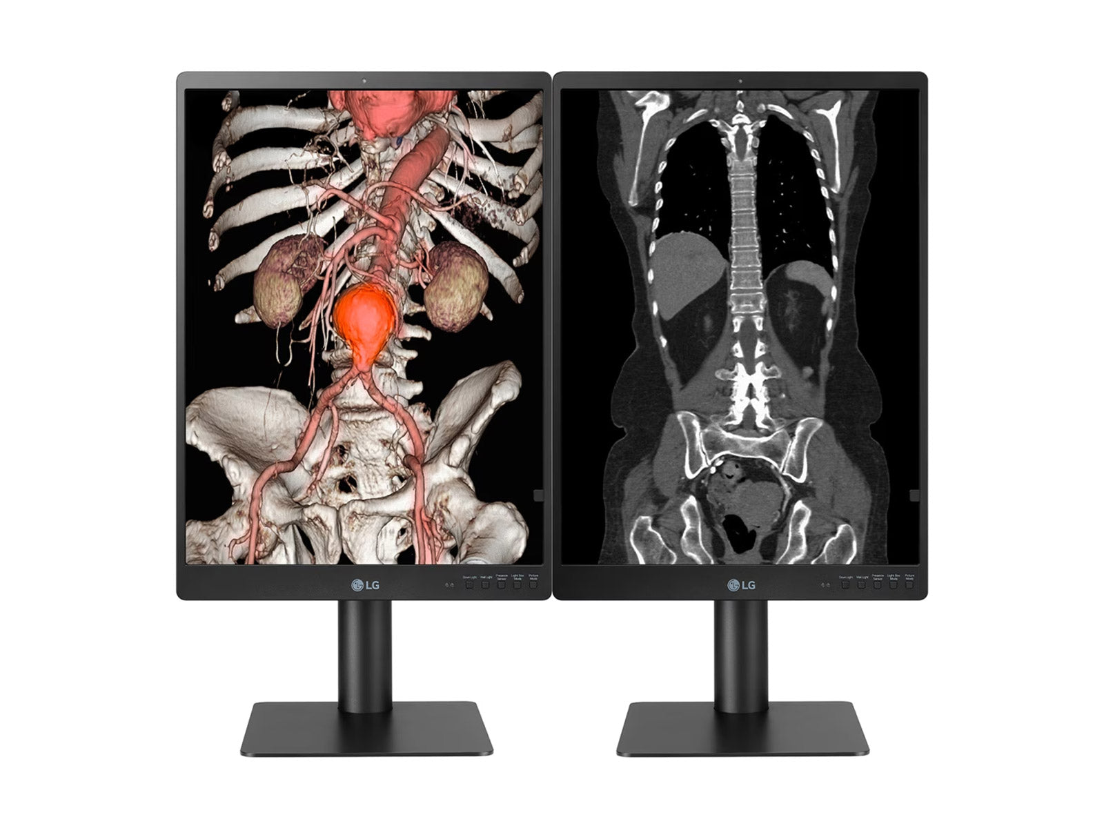 Complete PACS General Radiology Station | LG 21HQ513D 3MP 21" Color | HP Z2 G9 SFF Workstation | Dictation Mic | Worklist Monitor (21HQ513DZ2G9SFF)