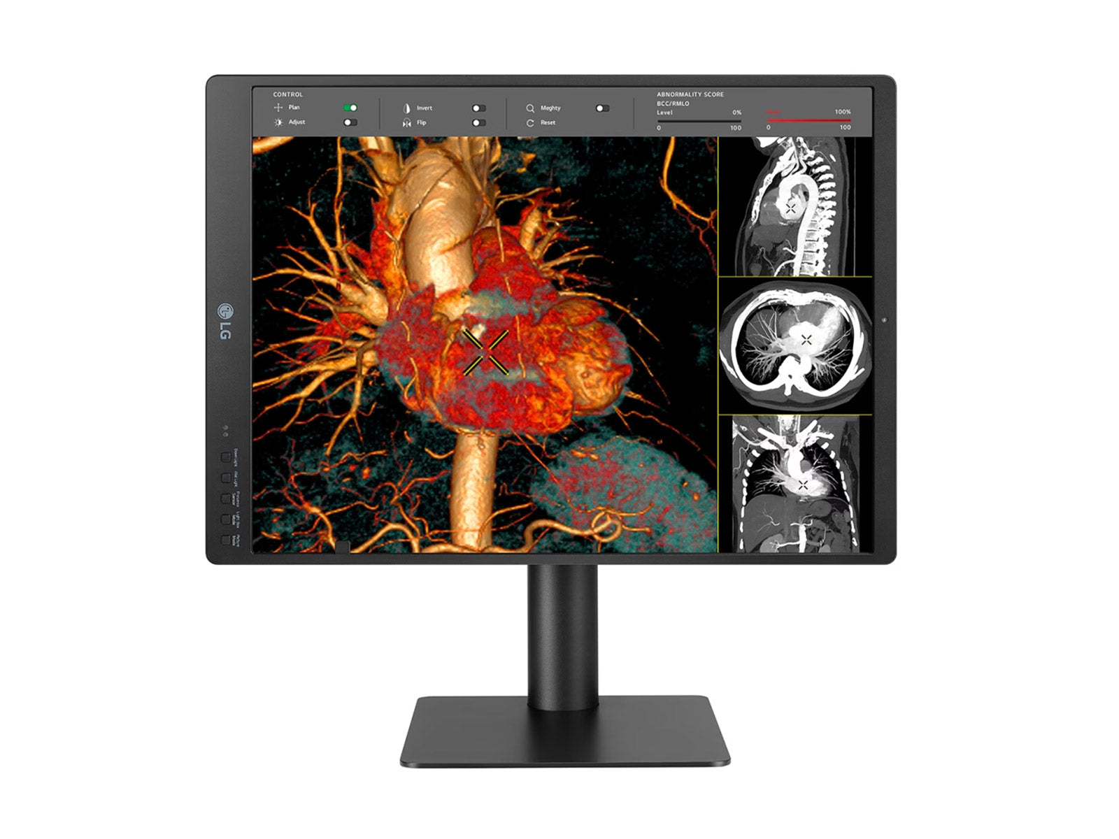LG 21HQ513D 3MP 21" Color Medical Diagnostic Radiology Display Monitor (21HQ513D)