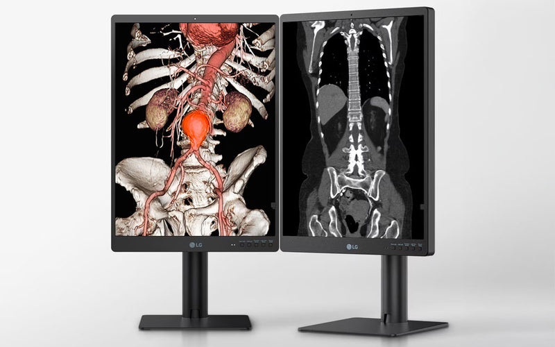 LG 21.3'' 3MP Color General Radiology Diagnostic Monitors