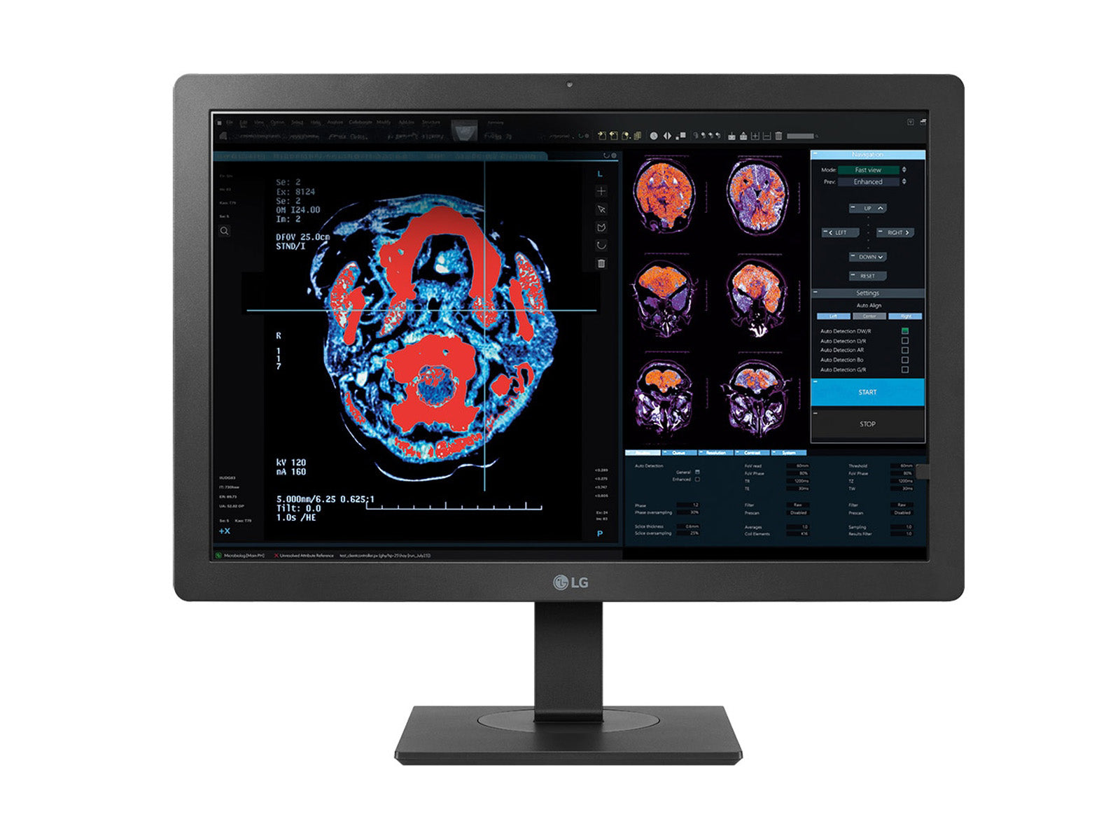 LG 2MP 24" Color LED Clinical Review Display Monitor with Auto DICOM calibration (24HR513C)