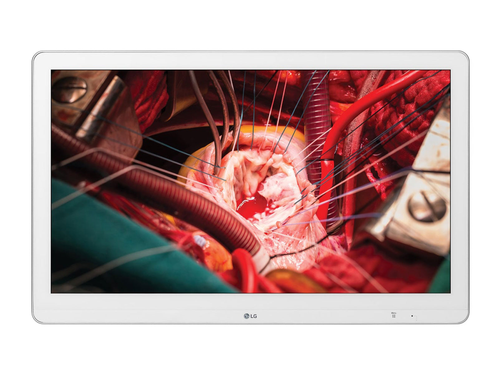 LG 27'' 27HK510S-W Full HD 2MP IPS 3G-SDI Surgical Endoscopy Medical Display Monitor