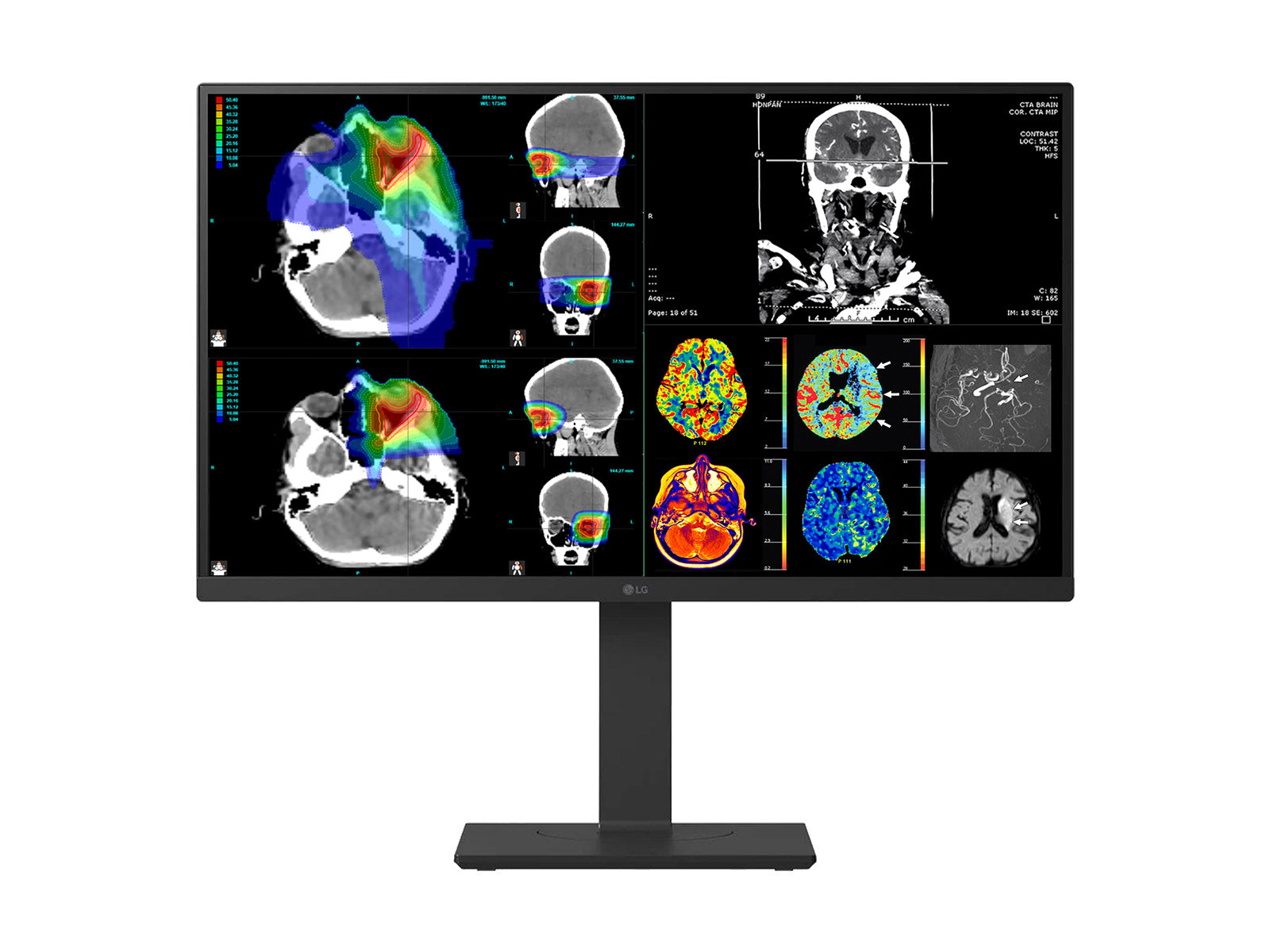 LG 27" Farb Fusion 8MP 4K LED Klinische Überprüfung Medizinisches DICOM Display Monitor (27HS713C) 