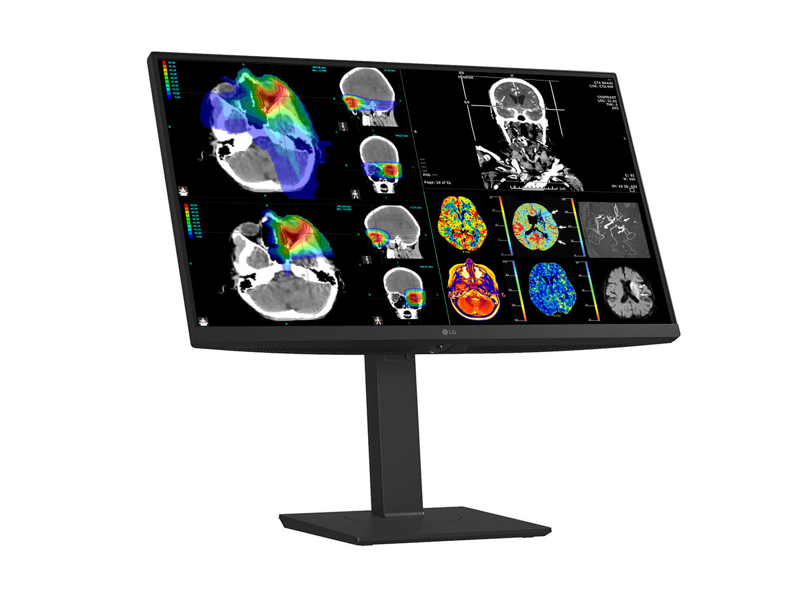 LG 27" Farb Fusion 8MP 4K LED Klinische Überprüfung Medizinisches DICOM Display Monitor (27HS713C) 