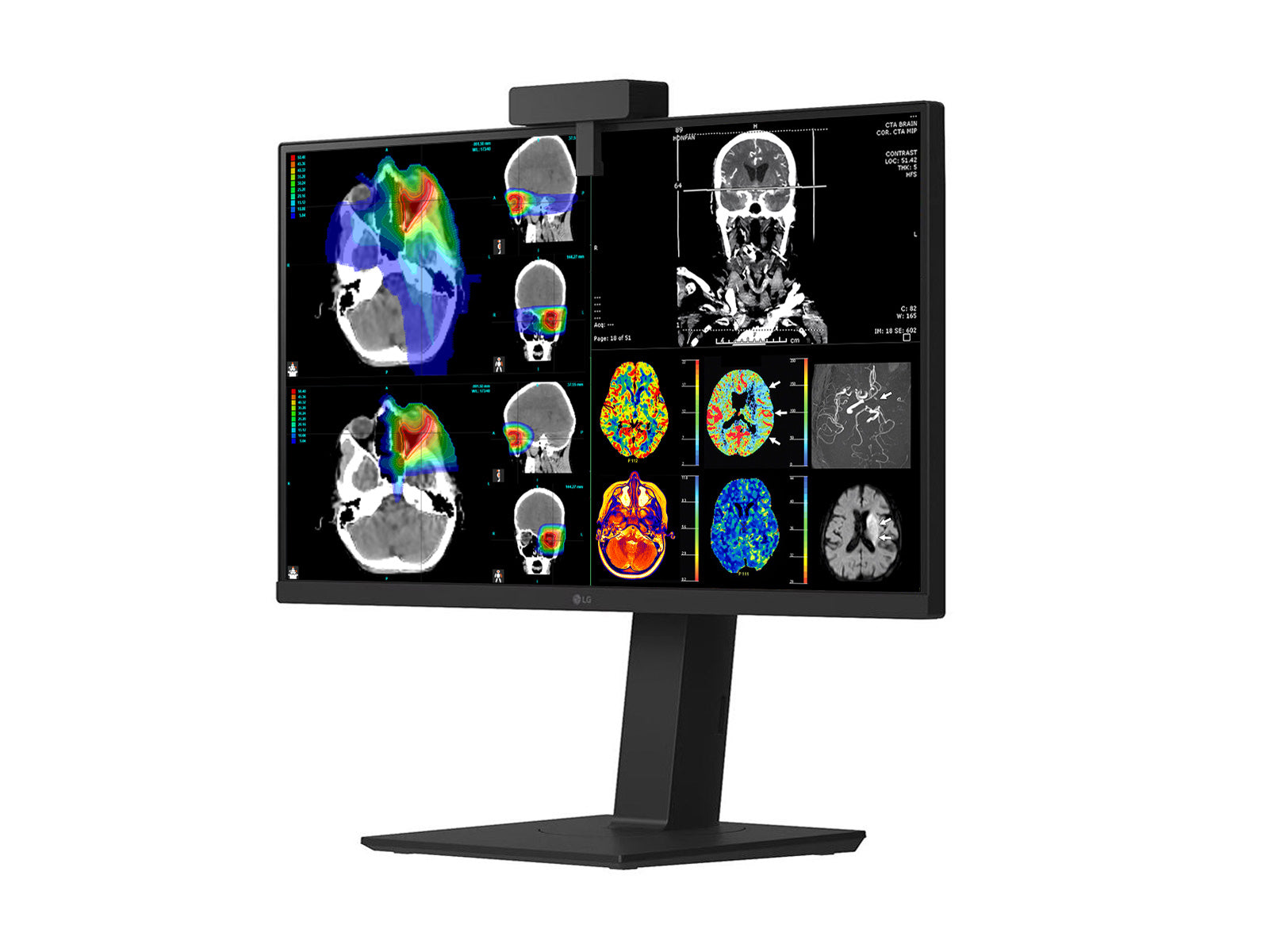 LG 27" Farb Fusion 8MP 4K LED Klinische Überprüfung Medizinisches DICOM Display Monitor (27HS713C) 