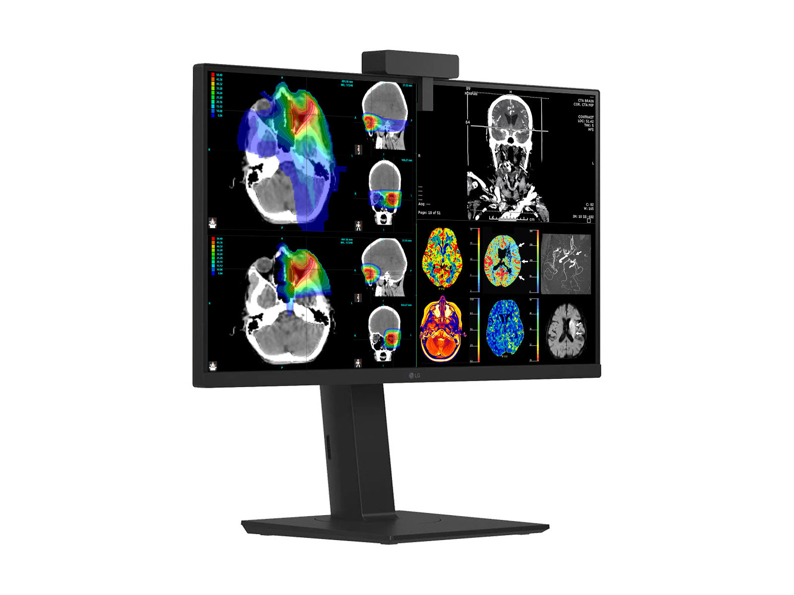LG 27" Farb Fusion 8MP 4K LED Klinische Überprüfung Medizinisches DICOM Display Monitor (27HS713C) 
