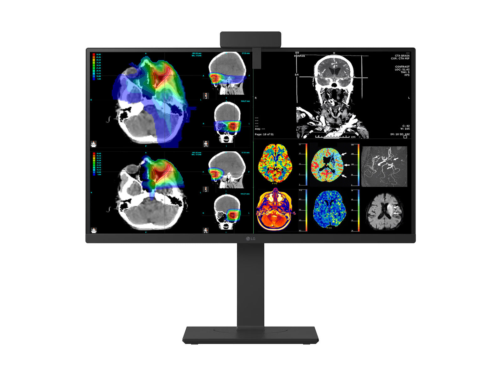 LG 27" Farb Fusion 8MP 4K LED Klinische Überprüfung Medizinisches DICOM Display Monitor (27HS713C) 