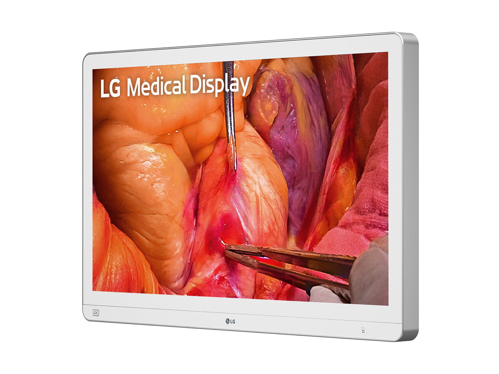 LG 27" 4K Moniteur d'affichage médical d'endoscopie chirurgicale Mini-LED 12G SDI (27HS714S-W)