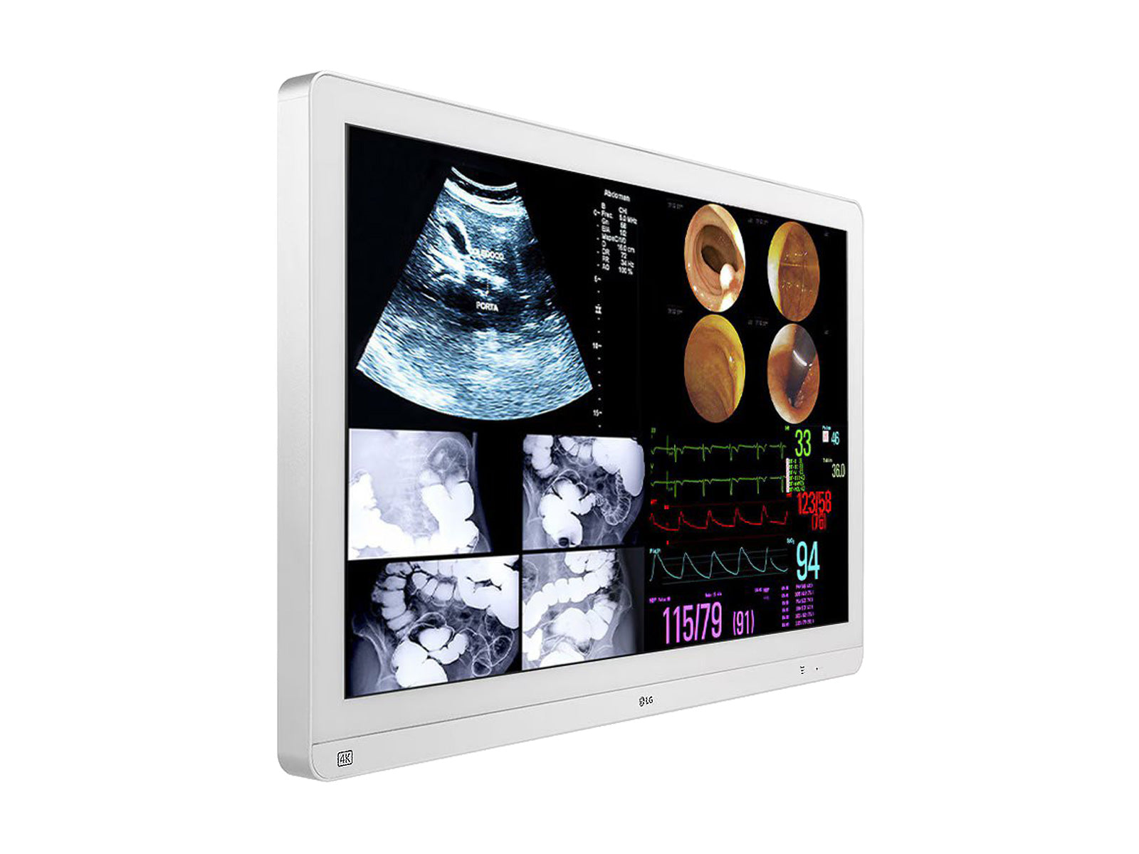 LG DEL 31,5" 4K Moniteur d'affichage d'endoscopie chirurgicale IPS 12G SDI (32HL714S-W)