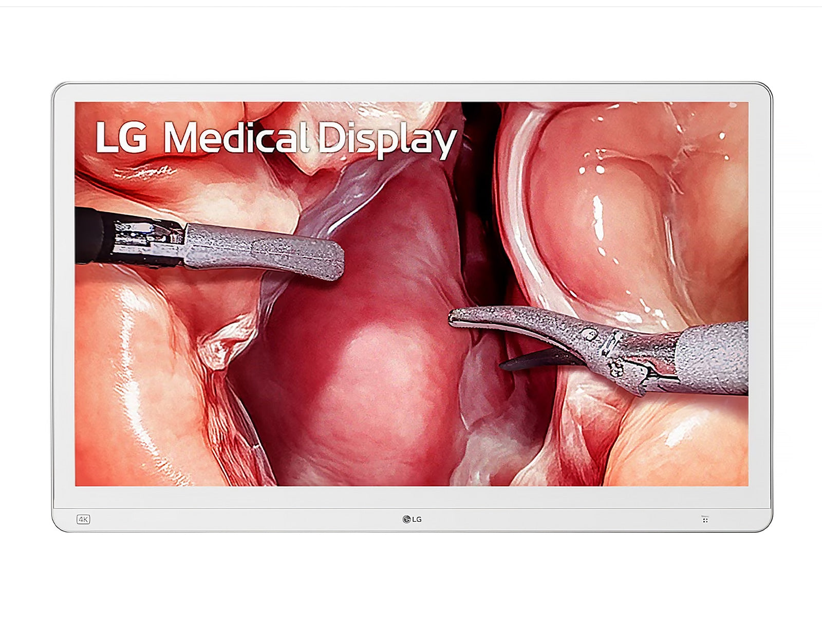 LG LED de 31,5"32HS710S-W 4K Monitor de pantalla médica para endoscopia quirúrgica 3G SDI