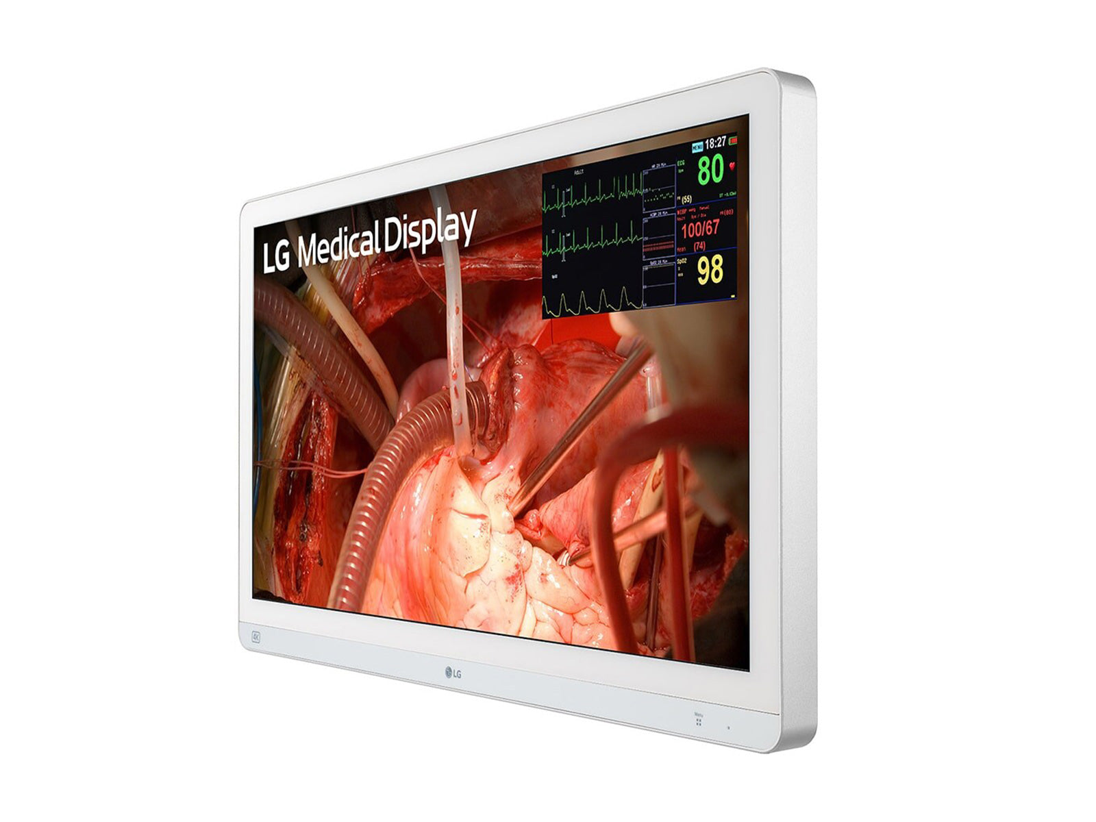 LG 27" 27HQ710S-W 4K Mini-LED 3G SDI Surgical Endoscopy Medical Display Monitor