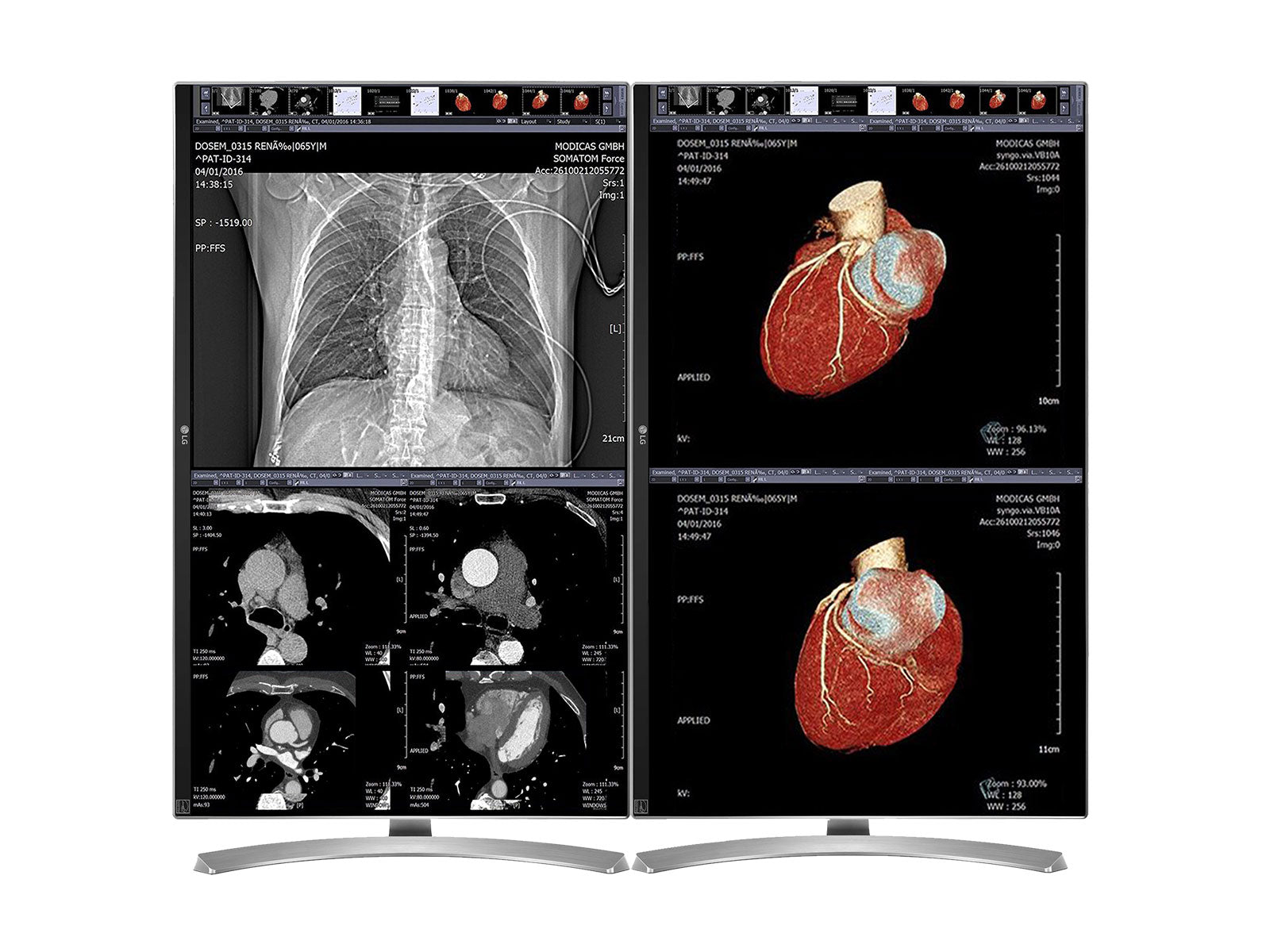 LG 27" 8MP Color Clinical Review Medical Display Monitor (27M-W)