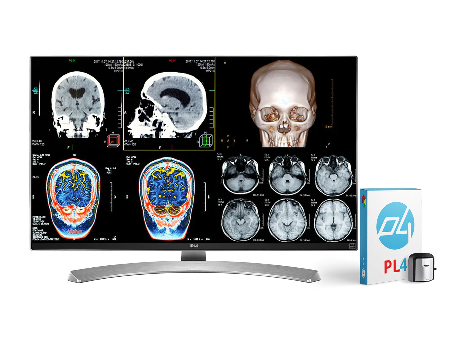 Komplette Lesestation für klinische Überprüfungen | 2 x LG 27" 8MP Farbdisplays für klinische Überprüfung | HP ZBook Studio 16 G10 | Diktiermikrofon | PerfectLUM Kalibrierpaket (LGHP16G10)
