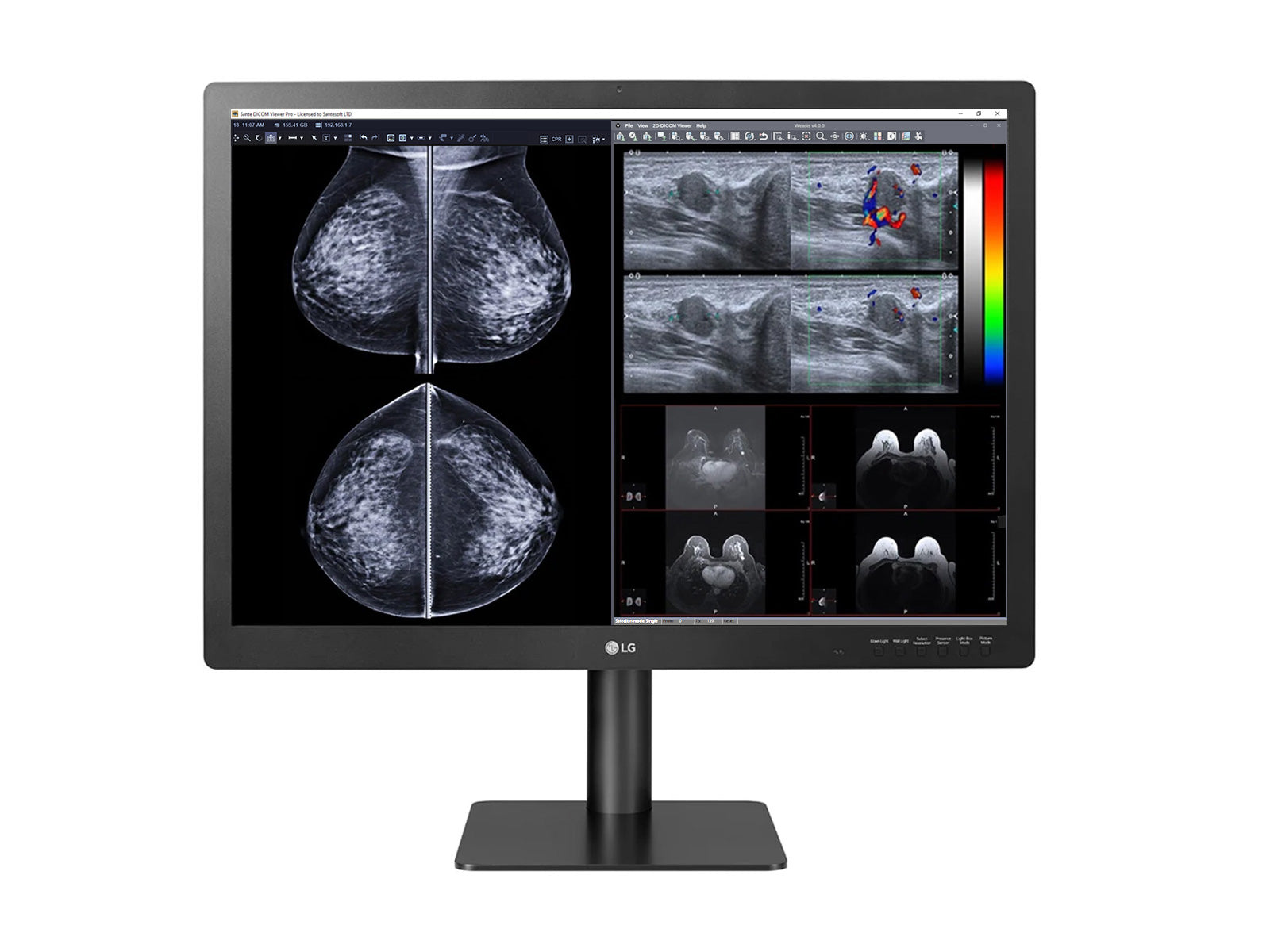 LG 12MP Fusion 31.5" Mammografia a Colori Display per Imaging al Seno 3D-Tomosintesi (31HN713D) 