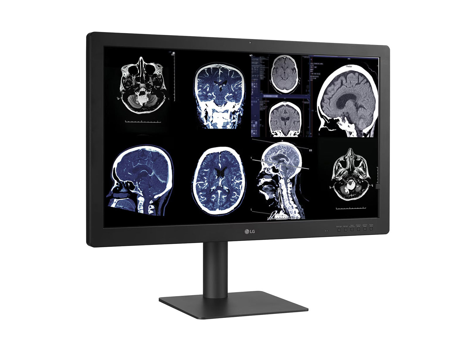 LG 32HQ713D 8MP 32" Diagnostic Fusion Color Medical Radiology PACS Monitor - 1000 cd/m² DICOM Brightness (32HQ713D)