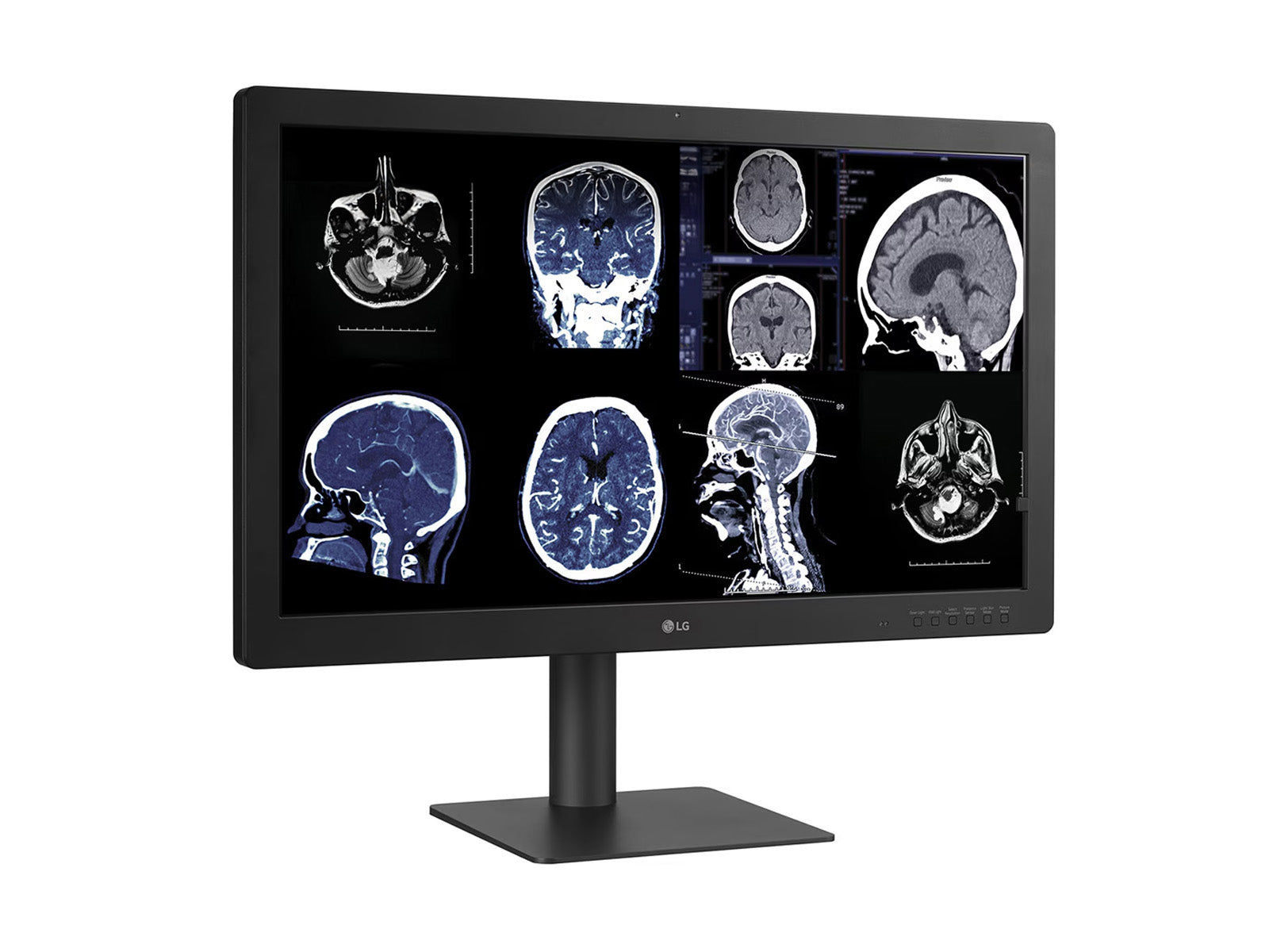 LG 32HQ713D 8MP 32" Diagnostic Fusion Color Medical Radiology PACS Monitor - 1000 cd/m² DICOM Brightness (32HQ713D)