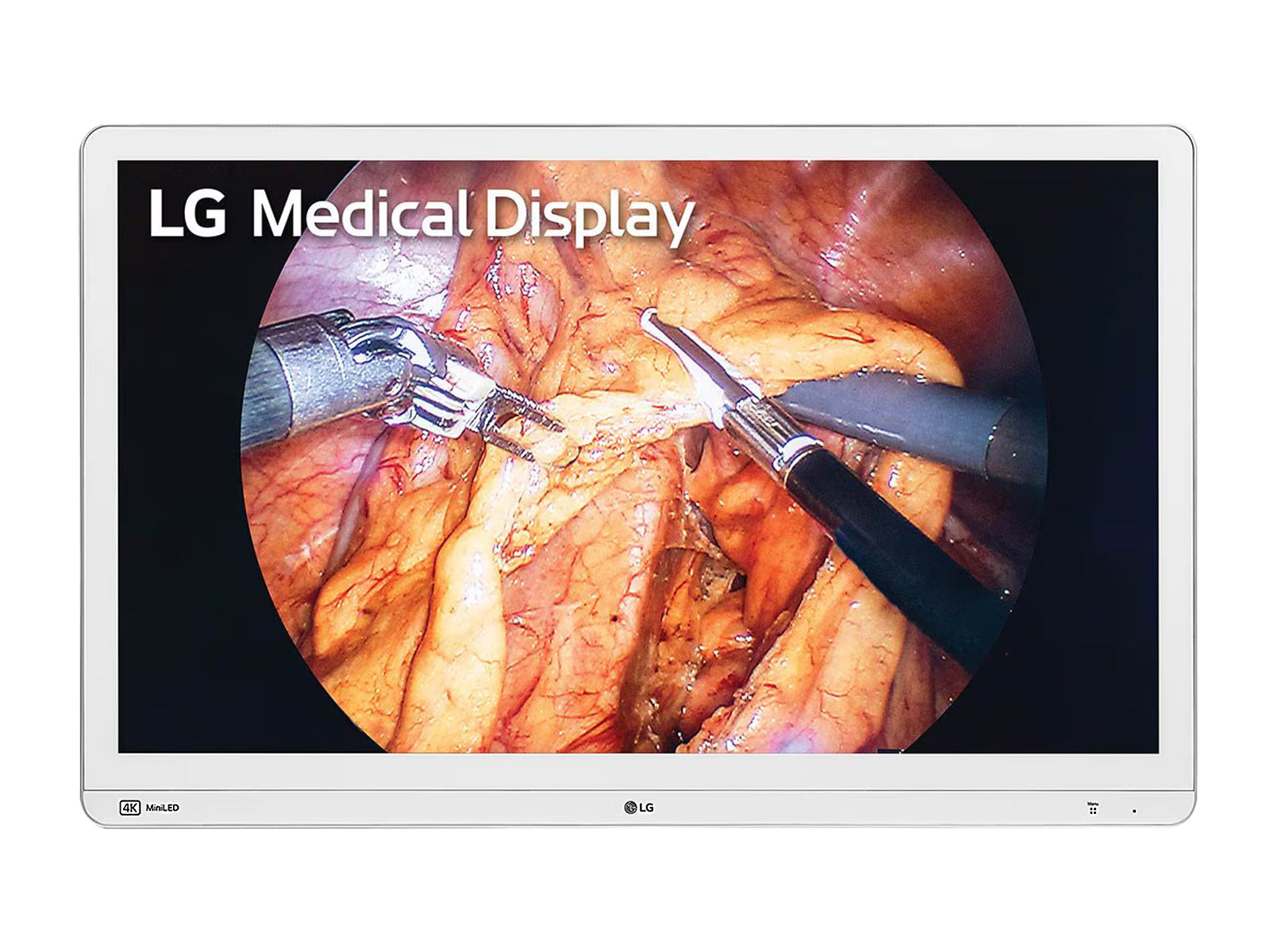 LG Mini-LED 31,5" 32HR734S-W 8MP 4K Monitor de pantalla médica para endoscopia quirúrgica UHD 12G SDI
