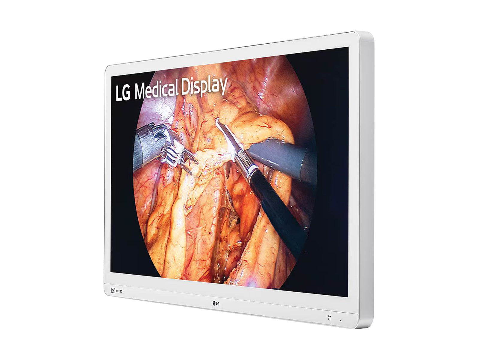 LG Mini-LED 31,5" 8MP 4K Moniteur d’affichage médical pour endoscopie chirurgicale UHD 12G SDI (32HR734S-W)