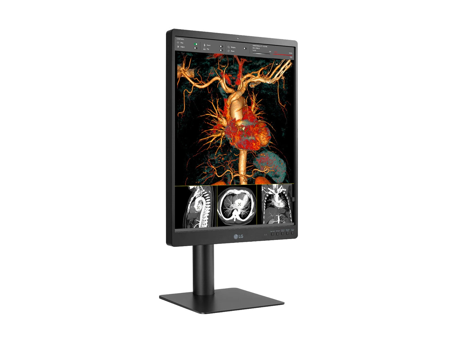 LG 21HQ513D 3MP 21" Color Medical Diagnostic Radiology Display Monitor (21HQ513D)