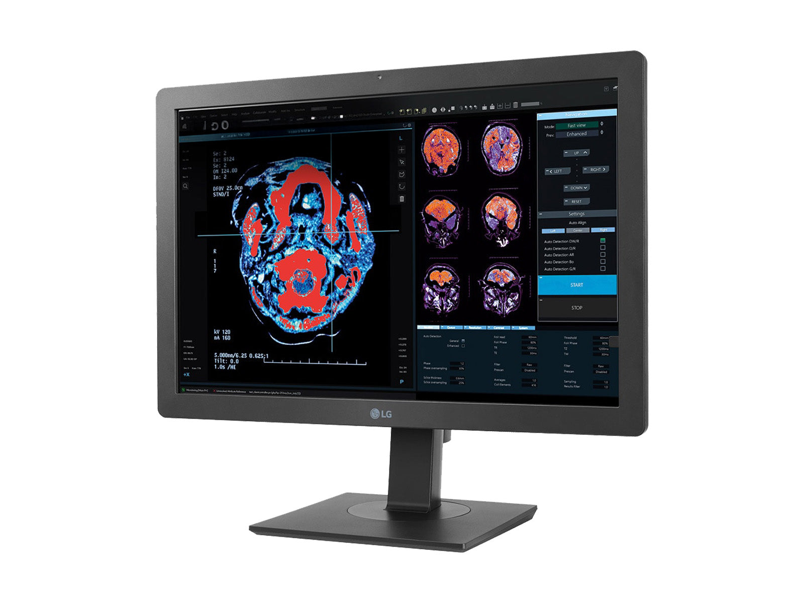 LG 2MP 24" Color LED Clinical Review Display Monitor with Auto DICOM calibration (24HR513C)
