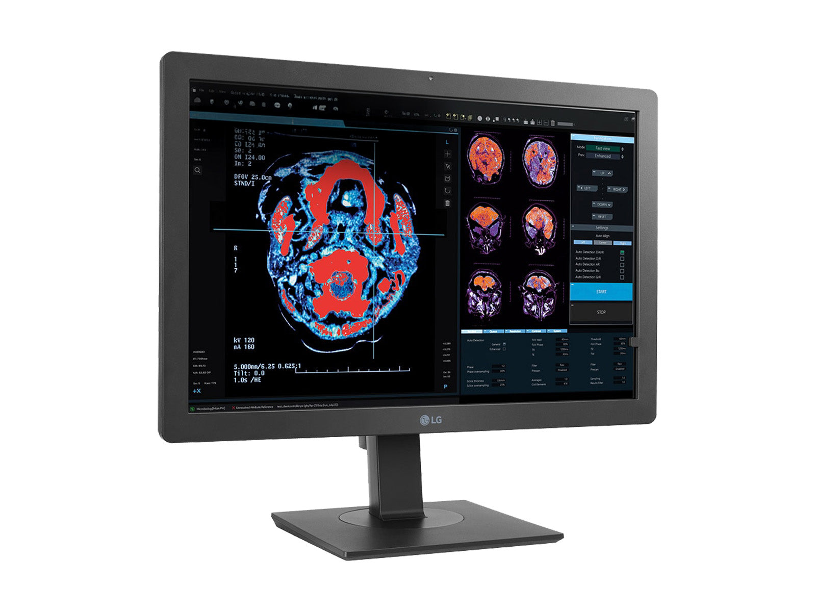LG 2MP 24" Color LED Clinical Review Display Monitor with Auto DICOM calibration (24HR513C)