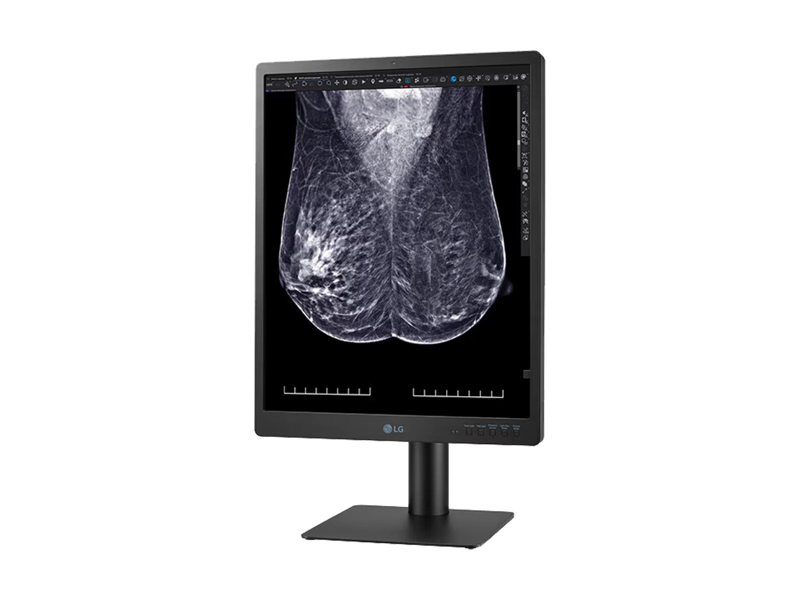 LG 5MP Monitor de pantalla de imágenes de mama 3D-Tomosynthesis mamografía en color de 21 "(21HQ613D)