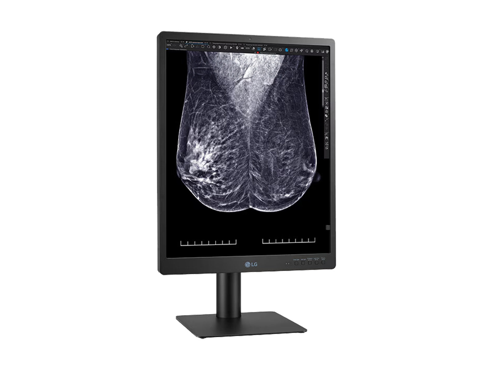 LG 5MP 21" Color Mammography 3D-Tomosynthesis Breast Imaging Display Monitor (21HQ613D)