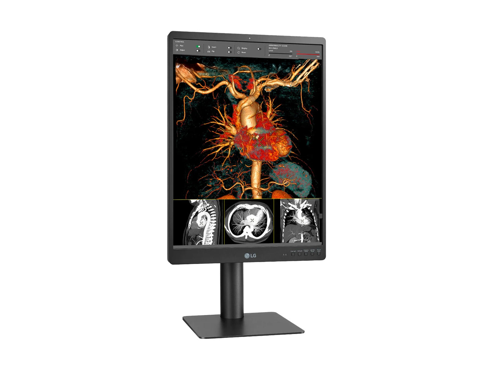 LG 21HQ513D 3MP 21" Color Medical Diagnostic Radiology Display Monitor (21HQ513D)