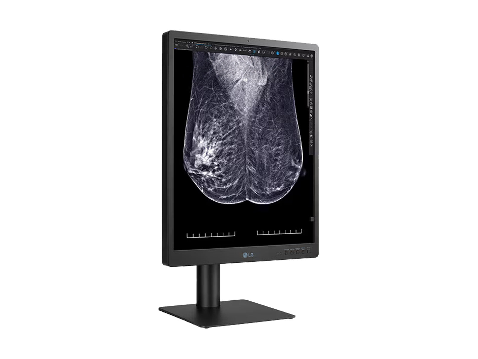 LG 5MP Monitor de pantalla de imágenes de mama 3D-Tomosynthesis mamografía en color de 21 "(21HQ613D)